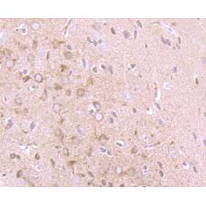 Anti-Ifna1 antibody