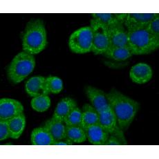 Anti-BNIP1 antibody