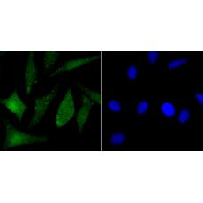 Anti-PARP1 antibody