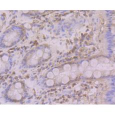 Anti-Atg12 antibody