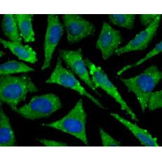 Anti-TAK1 antibody