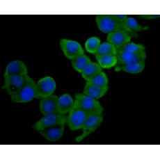 Anti-NDRG2 antibody