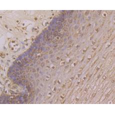 Anti-KV4.3 antibody