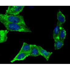 Anti-UAP1 antibody