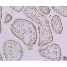 Anti-macroH2A.1 antibody