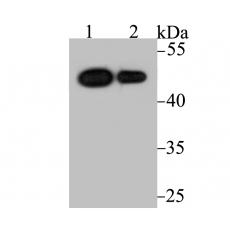 Anti-Vitamin D3 Receptor antibody