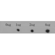 Anti-RYR1 antibody