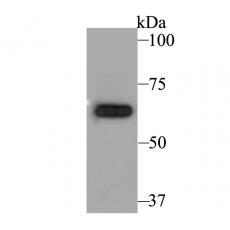 Anti-KCNA5 antibody