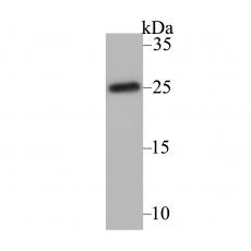 Anti-CACNG1 antibody