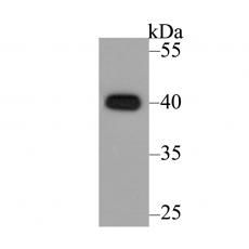 Anti-CACNG5 antibody