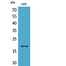 Anti-Acetyl eIF5A/eIF5A2 (K47) antibody