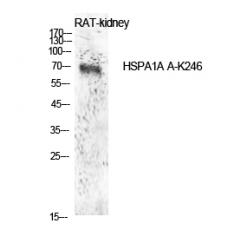 Anti-HSP70 (Acetyl Lys246) antibody