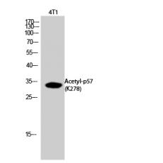 Anti-p57 (Acetyl Lys278) antibody