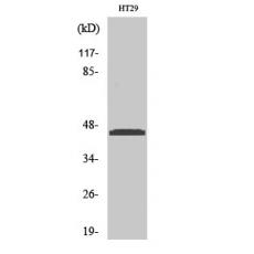 Anti-Ribosomal Protein L3 antibody