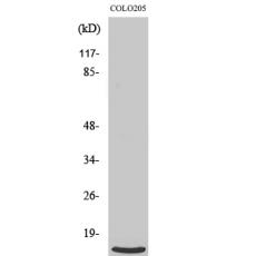 Anti-Ribosomal Protein L39 antibody