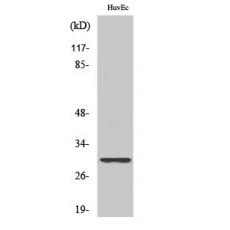 Anti-Ribosomal Protein S4Y1 antibody