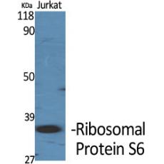 Anti-Ribosomal Protein S6 antibody