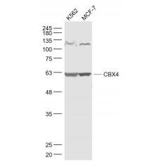 Anti-CBX4 antibody