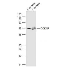 Anti-CCKAR antibody