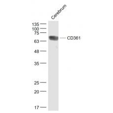 Anti-CD361 antibody