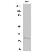 Anti-Ribosomal Protein S8 antibody