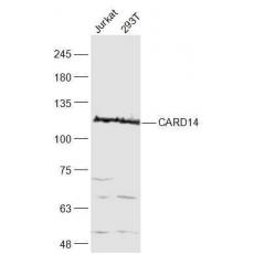 Anti-CARD14 antibody