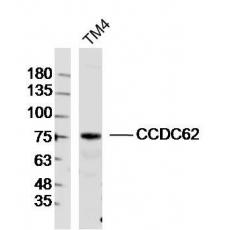 Anti-CCDC62 antibody