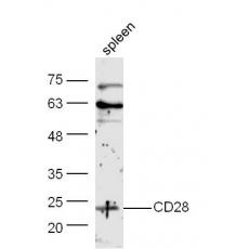 Anti-CD28 antibody