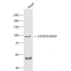 Anti-CD167b/DDR2 antibody