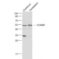 Anti-CCKBR antibody