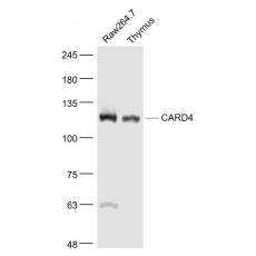 Anti-CARD4 antibody