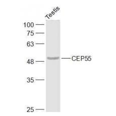 Anti-CEP55 antibody