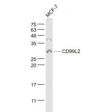 Anti-CD99L2 antibody