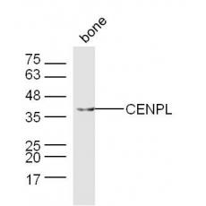 Anti-CENPL antibody