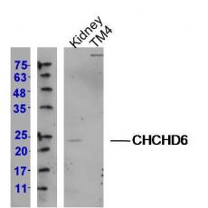 Anti-CHCHD6 antibody