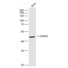 Anti-ChRM2 antibody