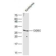 Anti-CHST6 antibody