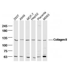 Anti-Collagen II antibody