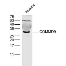 Anti-COMMD9 antibody