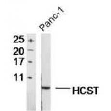 Anti-HCST antibody