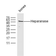 Anti-Heparanase antibody