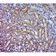 Anti-FSD1L antibody