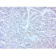 Anti-FZD3 antibody