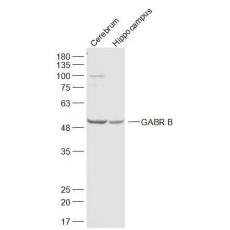 Anti-GABR B3 antibody