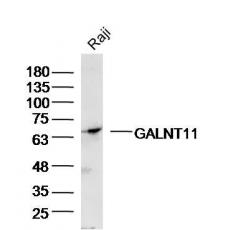 Anti-GALNT11 antibody