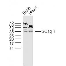 Anti-GC1q R antibody