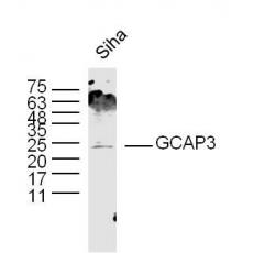 Anti-GCAP3 antibody