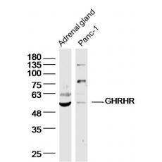 Anti-GHRHR antibody