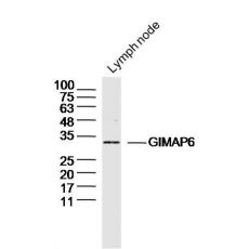 Anti-GIMAP6 antibody