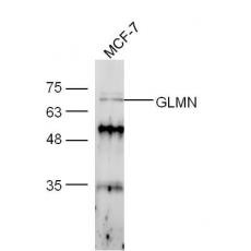 Anti-GLMN antibody